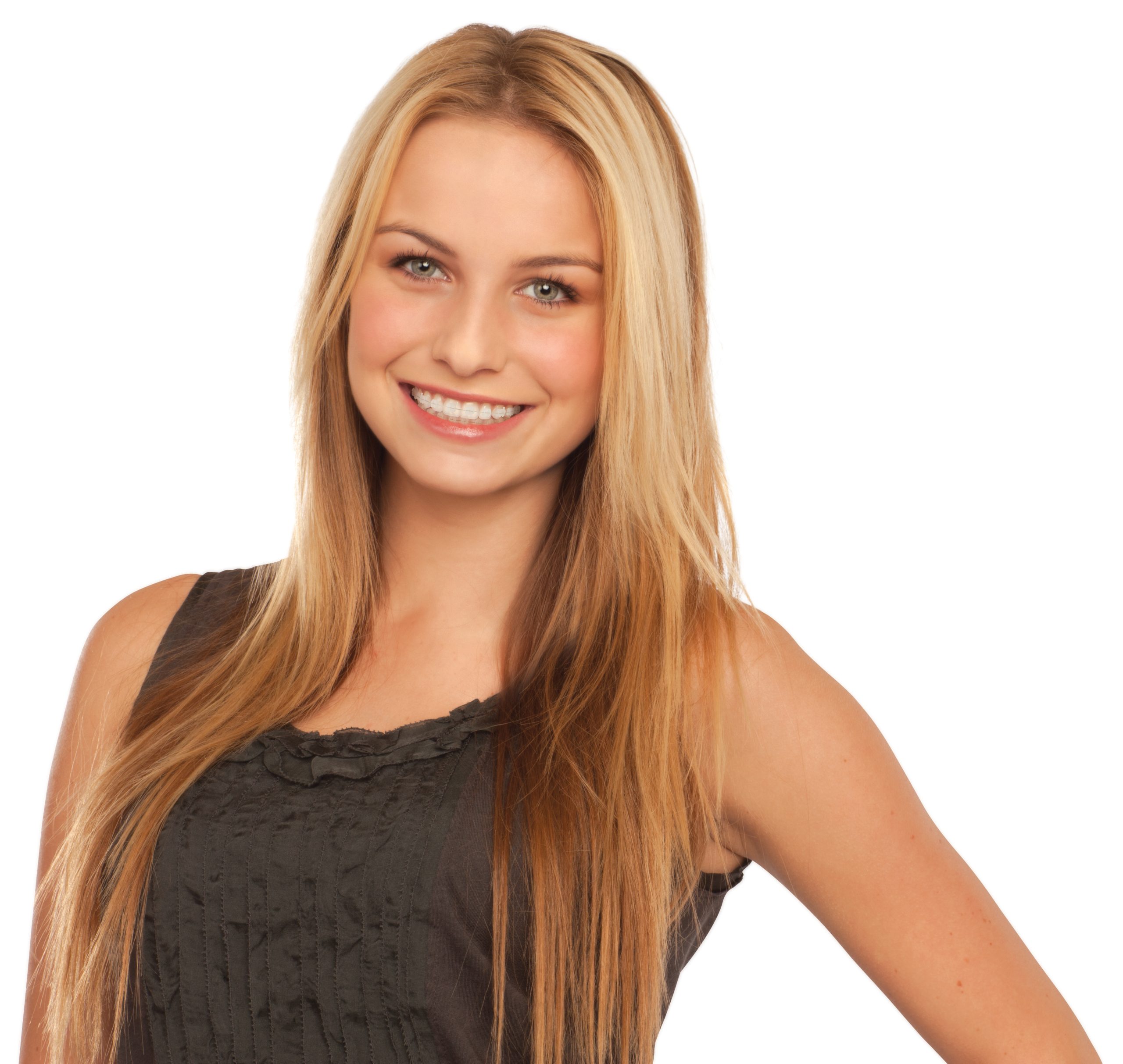 https://www.celebrityortho.com/wp-content/uploads/2023/12/ClarityADV-blond-model-HR-scaled.jpg